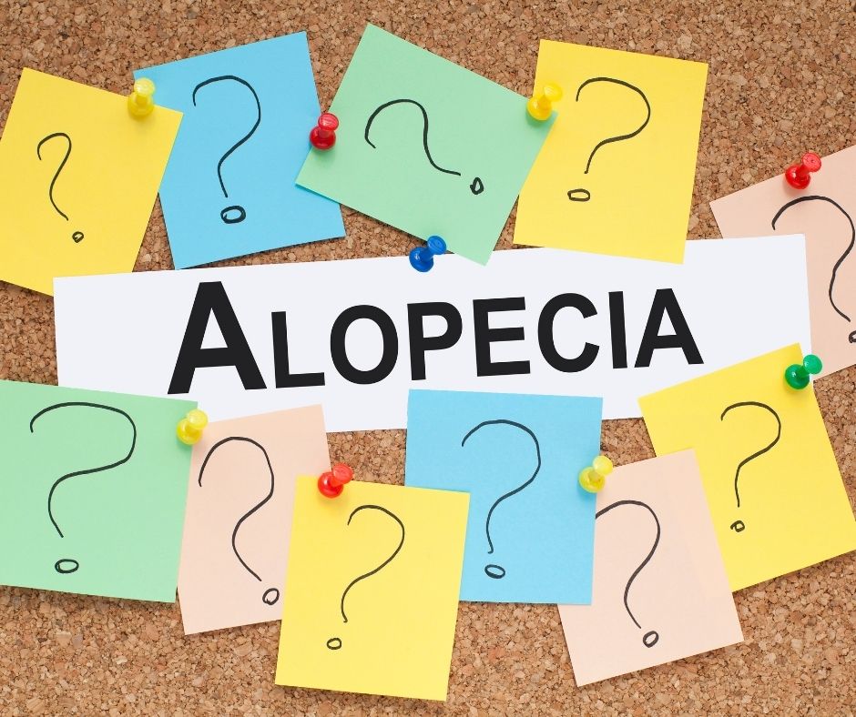 cause e cura dell’Alopecia Areata